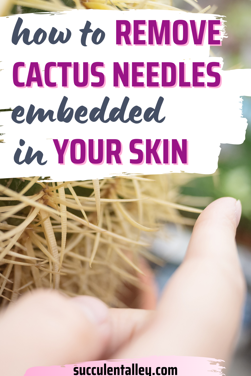Cactus Needles Embedded in Skin? Don't Panic, Follow These Easy Tips